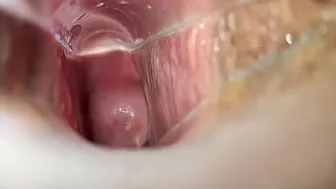 Speculum Inside Pussy