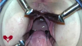 The Mistress' Cunt Is Opened With A Hole Expander So That You Can Study Her Cervix