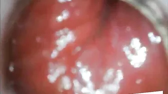 Anal Endoscope Ass Play From Inside