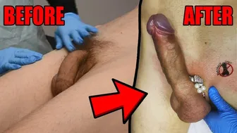 Dick Wax Depilation By Cute Esthetician. Before And After