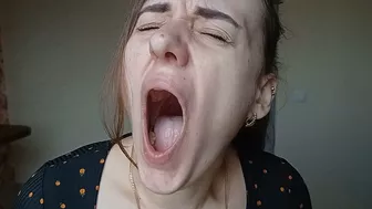 Severe Uncontrollable Yawning