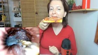 Pizza With Tropea Onions And Sausage - Exploration Inside The Stomach With Pillcam 720Hd